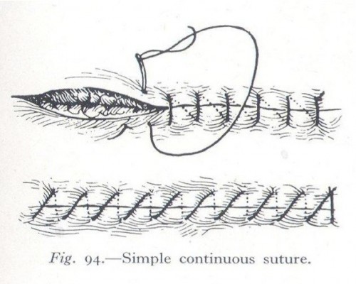 Fig. 3: Simple Continuous Suture from Surgery for Nurses by James Kemble (1949) via The Serendipity Project (http://serendipityproject.wordpress.com/) 